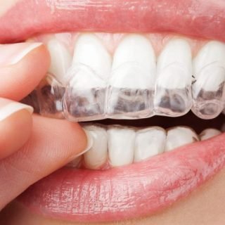 https://dayspringoakville.ca/wp-content/uploads/2021/08/Invisalign_slide2-768-320x320.jpg